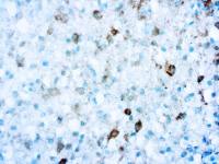 IDH1 (R132S Mutant) antibody [R132S]