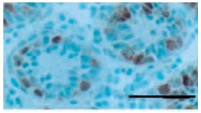 Germ cell-specific antigen antibody [TRA98]