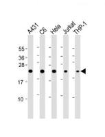 CDC42 antibody, Internal