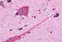 Dopamine Receptor D2 antibody