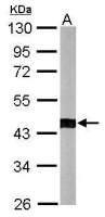 ACTR1B antibody