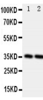 Podoplanin antibody