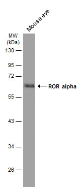 ROR alpha antibody [C3], C-term