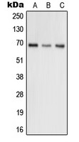 GRK5 antibody