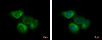 EIF2B delta antibody