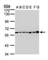 C2 / C2a antibody [N3C3]