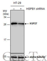 HSP27 antibody