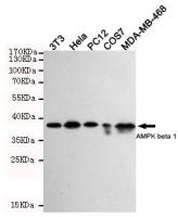 AMPK beta 1 antibody [1A7]