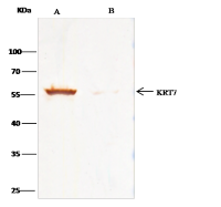 Cytokeratin 7 antibody