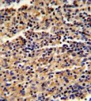 ALKBH8 antibody, C-term
