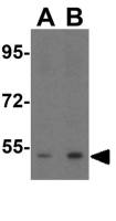 CX3CR1 antibody