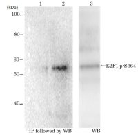 E2F1 (phospho Ser364) antibody [#2]