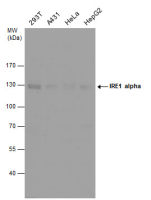 IRE1 alpha antibody [N1N2], N-term
