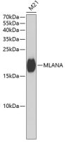 Melan A antibody