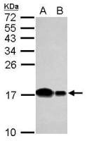UBE2D2 antibody