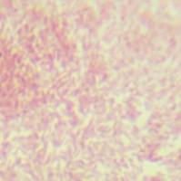 肠致病性大肠埃希氏菌