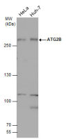 ATG2B antibody