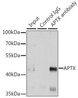 Aprataxin antibody