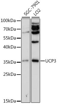 UCP3 antibody