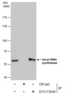 Seryl-tRNA synthetase antibody [N1C2]
