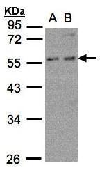 PFKFB4 antibody [N3C3]