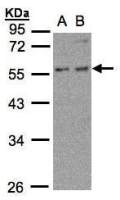 PFKFB4 antibody [N3C3]