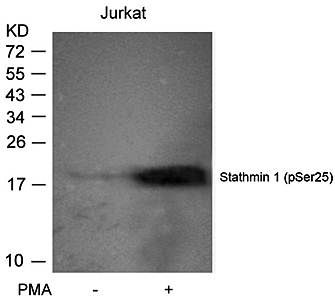 Stathmin 1 (phospho Ser25) antibody