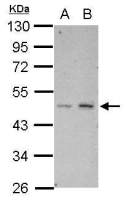 HTRA3 antibody