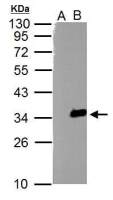 TZFP antibody