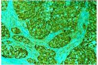 MUC1 antibody [GP1.4]