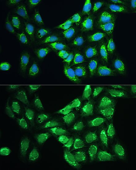 Peroxiredoxin 5 antibody