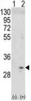 ITM2A antibody, N-term