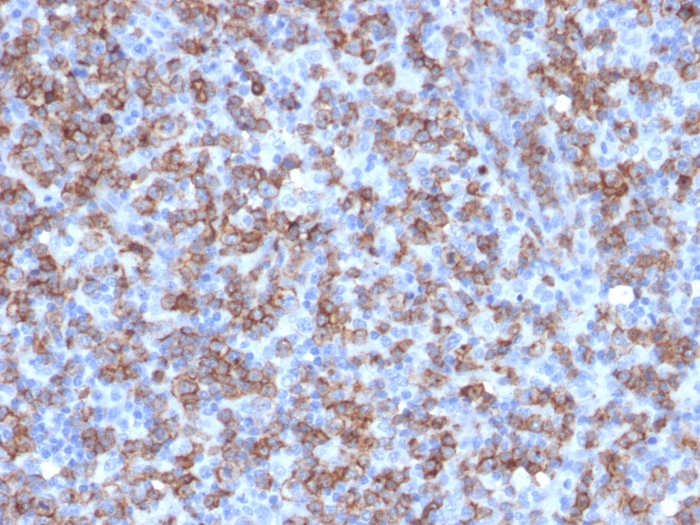 CD8 alpha antibody [C8/1779R]
