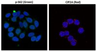 c-Myc (phospho Ser62) antibody [33A12E10]
