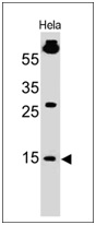 SUMO1 antibody [SM1/495]