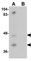 TMPRSS11A antibody