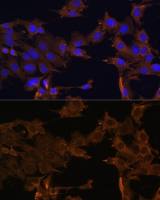 PDGF Receptor beta antibody