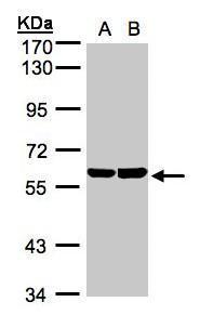 TBRG4 antibody