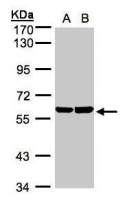 TBRG4 antibody