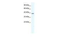 KCNK13 antibody, C-term