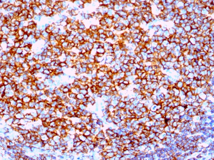 CD20 antibody [IGEL/1497R]