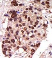 PKC nu antibody