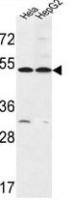 FERMT1 antibody, Internal