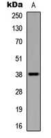 UBE2U antibody