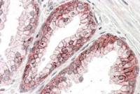 alpha 1 Catenin antibody, Internal