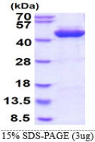 Human Alcohol dehydrogenase 1C protein, His tag