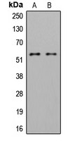 LYN (phospho Tyr508) antibody