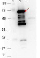 Borrelia burgdorferi p35 antibody