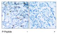 CDC2 (phospho Thr161) antibody
