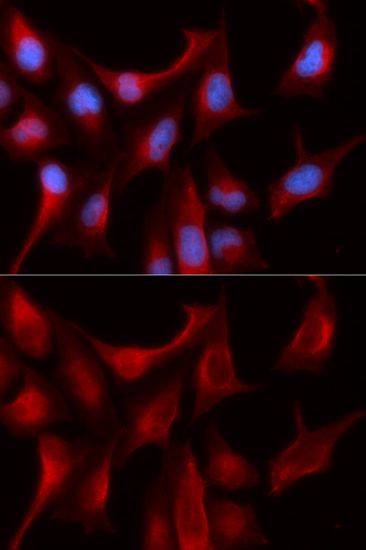 Proteasome beta 4 antibody